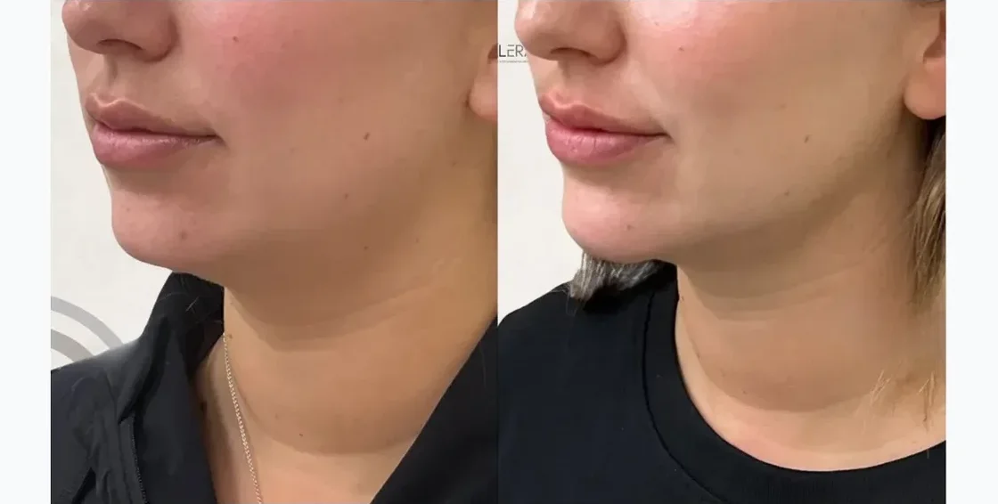 Jawline